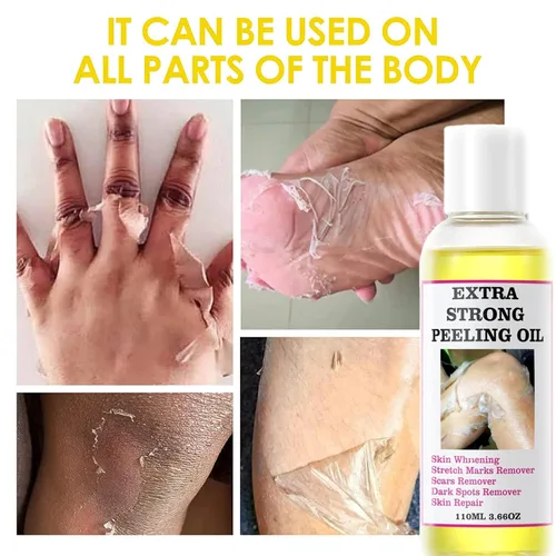 Vista 2 de Aceite de pelado químico extra fuerte amarillo, aceite químico para piel oscura, solución exfoliante para el cuerpo, todo tipo de piel, 3.7 fl