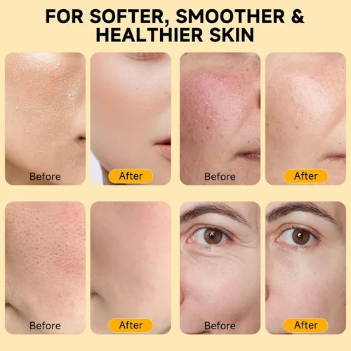 Vista 3 de Bálsamo orgánico de sebo de res con miel para piel y cara, hidratante facial de sebo de res batido con miel cruda, crema de sebo de res alimentada