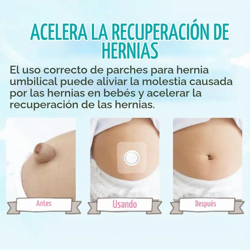 Vista 6 de Parches para el ombligo del bebé (5 piezas), moldeador de ombligo con almohadillas de algodón impermeables, imprescindibles para bebés, envoltura