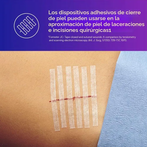 Vista 5 de 3M R1546 Steri-Strip - Cintas adhesivas reforzadas, 5 empaques de 10 (50 tiras)