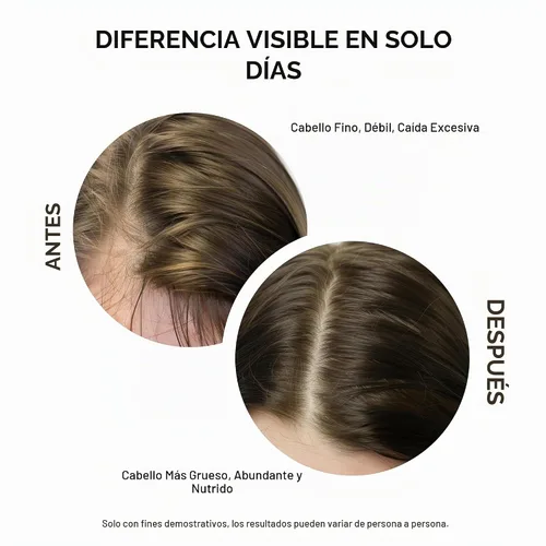 Vista 5 de Masofta - Suero de densidad del cabello para el crecimiento, cabello más completo y denso con 3% de redensyl, 5% capixyl, 4% anagain, 3% Procapil