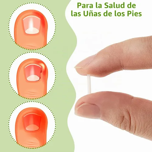 Vista 5 de Tiras correctoras de uñas encarnadas profesionales, 50 tiras correctoras de uñas encarnadas, tiras curvadas para enderezar las uñas del pie, clips