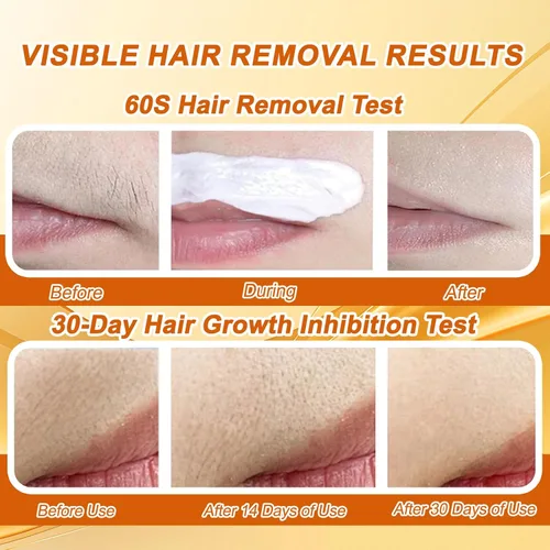 Vista 5 de Joy Pretty - Removedor de vello facial para piel sensible, Joy Cream depilación facial para mujeres, crema de depilación facial suave para mujeres