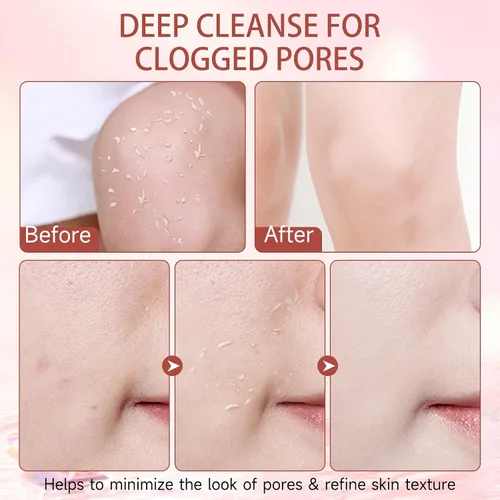 Vista 9 de Gel exfoliante purificador, limpiador exfoliante facial suave, gel exfoliante hidratante natural para cara y cuerpo, limpieza profunda e hidratante
