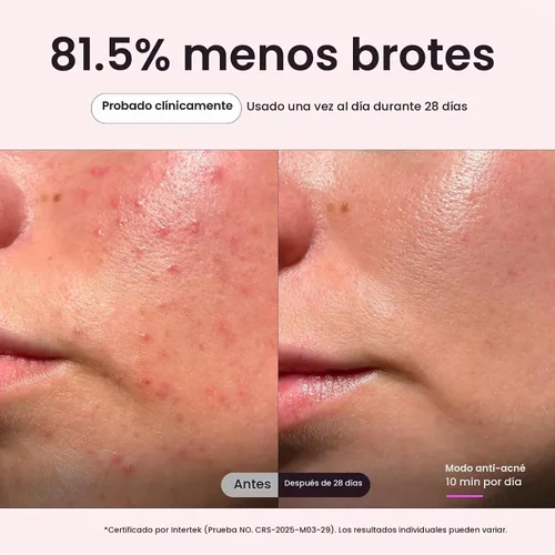Vista 5 de Wavytalk Máscara de terapia de luz roja para cara, ELLE mejor herramienta Rosa