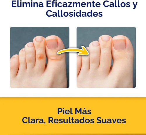 Vista 3 de CornStick Removedor de Callos y Callosidades de Ácido Salicílico de Máxima Potencia en Barra Sólida 0.2 Oz Fuerza máxima - 40% de ácido salicílico