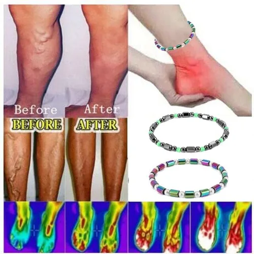 Vista 2 de Tobilleras de obsidiana negra para mujer, 2 tobilleras antihinchazón magnéticas delgadas de hematita y antiansiedad para yoga, Sin gemas.