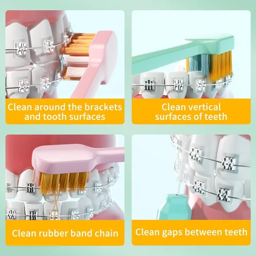 Vista 3 de Y-Kelin Cepillo de dientes de ortodoncia 2IN1 con cepillo interdental