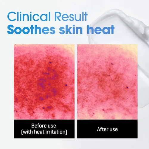 Vista 3 de SOME BY MI AHA BHA PHA 30 Days Miracle Acne Clear Body Cleanser & Beta-Pantenol Crema Corporal Reparadora