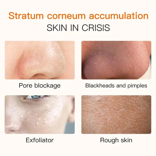 Vista 5 de Gel exfoliante naranja para cara y cuerpo - Exfoliante enzimático suave con extracto de naranja natural, exfoliante facial hidratante para todo tipo
