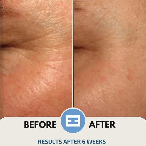 Vista 5 de EiE 01 Klotho Peptides Serum para la cara hidratante peptídico suero facial para mujeres, antienvejecimiento, mejora las arrugas, elasticidad