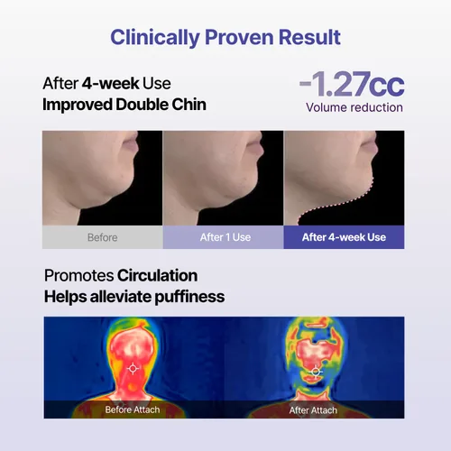 Vista 6 de Tension Up Mask - Máscara facial de colágeno coreano - Máscara de elevación de línea V - Hidratante, reafirmante y aprieta la piel para un contorno