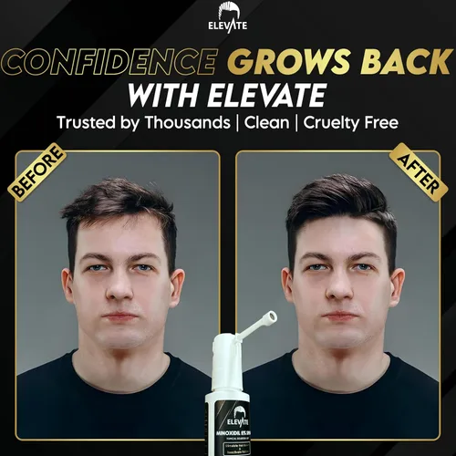 Vista 5 de Elevate Tratamiento de crecimiento del cabello 5% Minoxidil Spray para hombres – Fórmula clínicamente probada de rápida absorción para pérdida