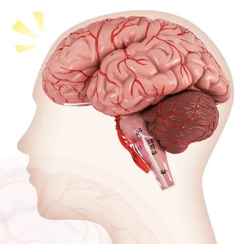 Vista 2 de Evotech - Modelo de cerebro humano con arterias, 9 partes de anatomía de tamaño real, modelo de cerebro en una base, muestra horizontal liso a Rojo