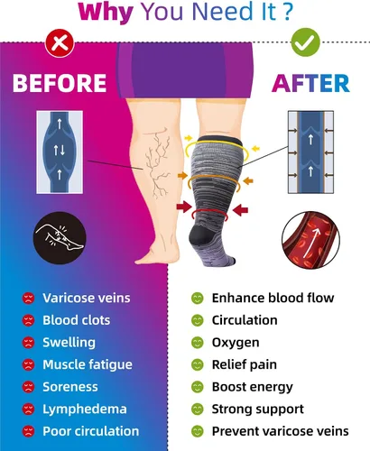 Vista 3 de RAYSHARP Paquete de 3 calcetines de compresión de talla grande para mujeres y hombres, medias altas hasta la rodilla de 20-30 mmHg para piernas