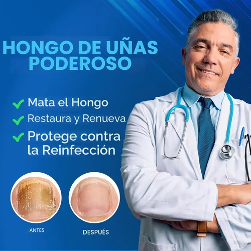 Vista 2 de Tratamiento de hongos en las uñas de los pies extra fuerte con 25% de ácido undecilénico y aceite de árbol de té, tratamiento de hongos en las uñas