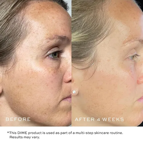 Vista 11 de DIME Beauty TBT Cream – Crema de noche antiarrugas con Bakuchiol Retinol alternativa para líneas finas, crema hidratante facial reafirmante