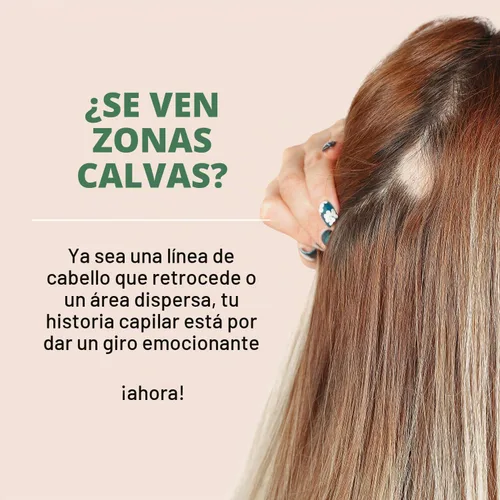 Vista 2 de Tratamiento calvicie. Crema manchas cuero cabelludo.