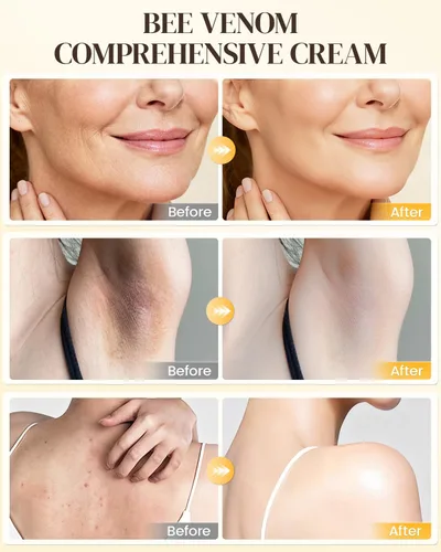 Vista 4 de Bee Venom Cream 2 unidades – Hidratante diario ligero para cara, cuello y cuerpo – Crema cosmética de absorción rápida, no grasa para la comodidad