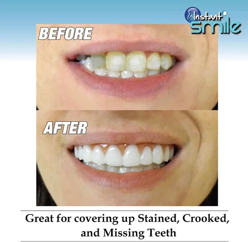 Vista 4 de Instant Sonrisa Comfort Flex, nuevo. Talla única. Arregla tu sonrisa en casa en cuestión de minutos. 5 Minutos adulto Makeover, Upper revestimiento