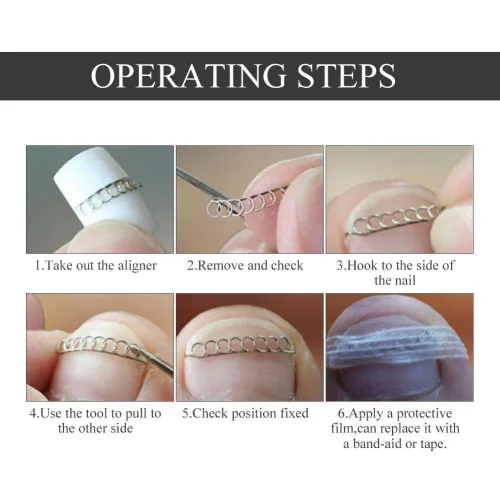 Vista 7 de Corrector de uñas pedicura herramienta de cuidado de pies, 12 unids/caja de herramienta de corrección de uñas de los pies, 6 tamaños encarnados