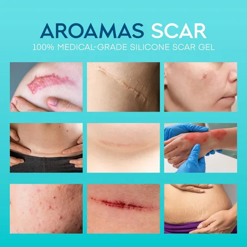 Vista 2 de Aroamas Scar Gel avanzado para cicatrices, gel de silicona de grado médico para ayudar a mejorar la apariencia de cicatrices y estrías para rostro