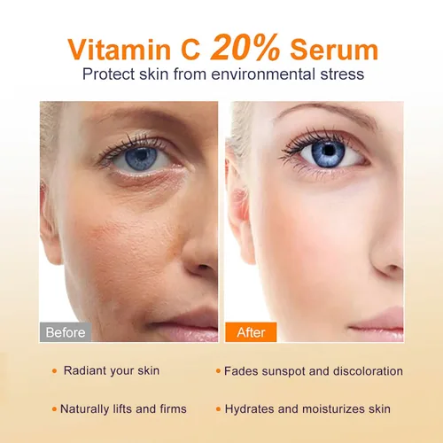 Vista 6 de Suero de vitamina C al 20 %, suero facial profesional de vitamina C antienvejecimiento, mejora el resplandor de la piel, reduce las líneas finas