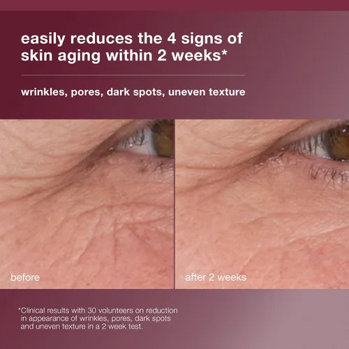 Vista 2 de Dermalogica Dynamic Skin Retinol Facial Serum with Multi-Retinoid Complex, Skin Retexturizing and Improving Skin Health