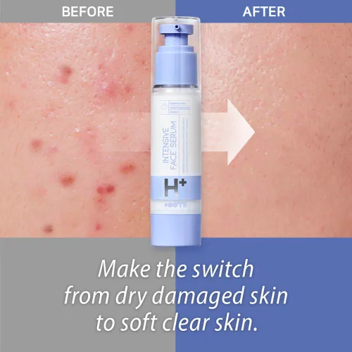 Vista 7 de Suero Hidratante Intensivo Coreano Hidratante Coreano, Hidratante, Revitalizante, Ácido Hialurónico, Hialuronato de Sodio, Crema Facial Vitamina C