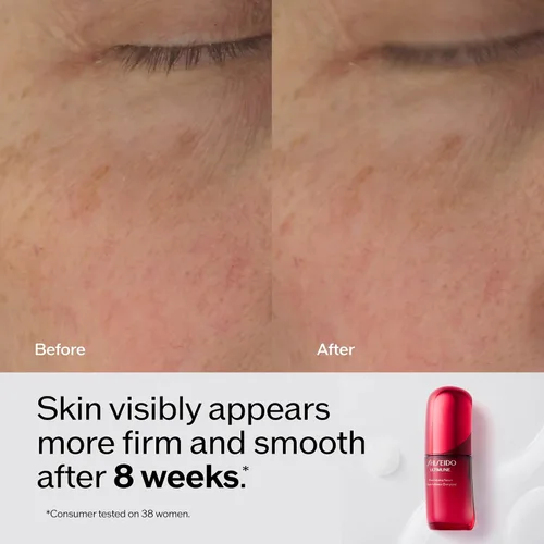 Vista 5 de Shiseido Ultimune Power Infusion Serum - Suero facial ligero innovador - Aumenta la luminosidad y mejora los signos visibles del envejecimiento