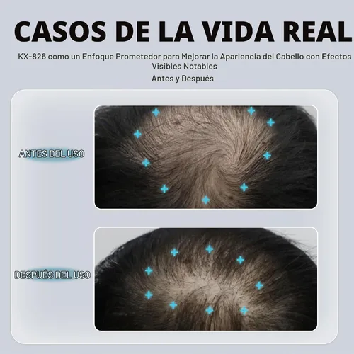 Vista 5 de KINTOR 0.5% KX-826 DHT Bloqueador de Vello Spray para Hombres y Mujeres 2 fl oz