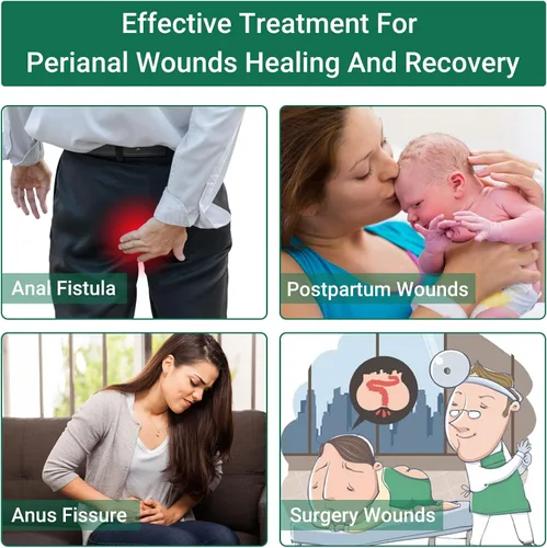 Vista 2 de LMNOOP® Crema de cuidado perianal, heridas de curación rápida para fisura del ano, absceso, úlcera, infección, cirugía posparto y fístula anal