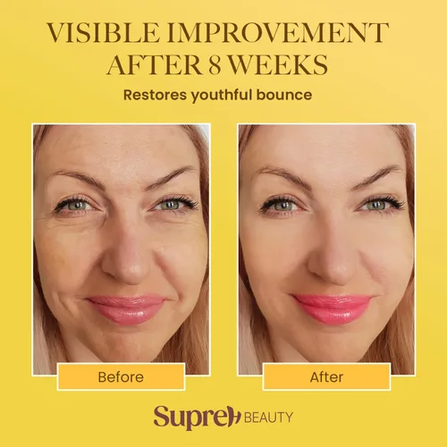 Vista 10 de SupreH Bee Venom Cream Wrinkle Filler: Crema de estiramiento facial instantáneo y crema tensora de ojos con ácido hialurónico niacinamida