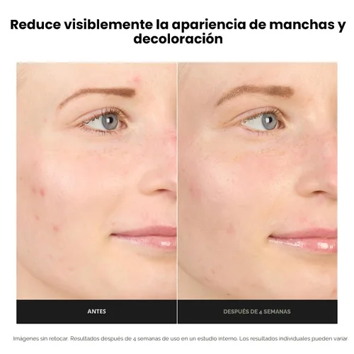 Vista 4 de Paula's Choice BOOST Crema Gel Potenciadora de Ácido Azelaico al 10% Suero Facial con Ácido Salicílico, Suero Iluminador de Piel Sin Aceite
