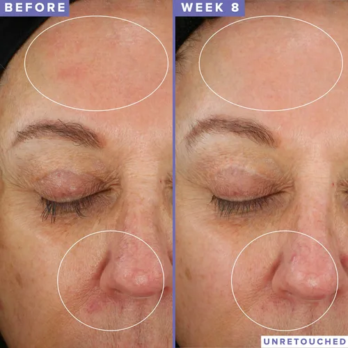 Vista 4 de Farmacy Máscara facial de niacinamida para la noche, máscara facial de refinación de poros con 10% de niacinamida, repone la barrera de humedad