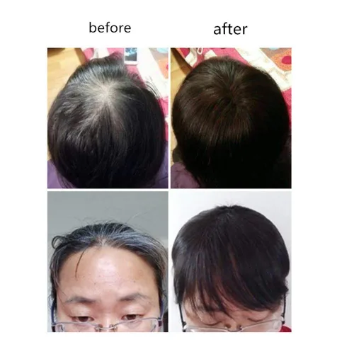 Vista 4 de Extensiones de cabello humano real con clip con flequillo, peluca para cabello fino para mujer (8 pulgadas, marrón oscuro)