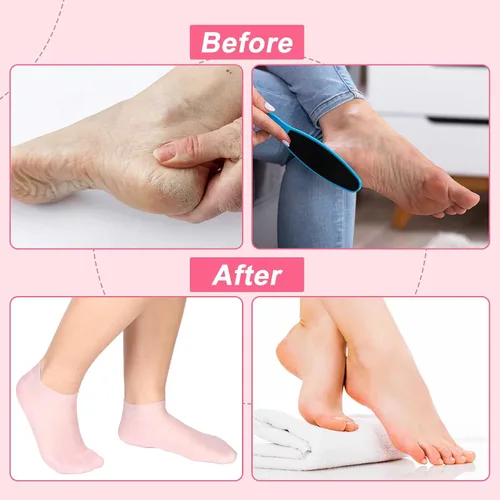 Vista 5 de SATINIOR 3 pares de calcetines de silicona para pies secos y agrietados, terapia de pies, spa, pedicura, calcetines de silicona reparadores