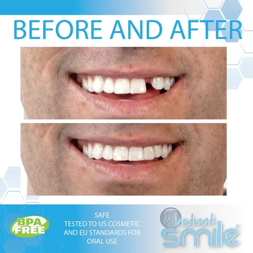 Vista 2 de Instant Smile Perlas de ajuste temporal de reemplazo de dientes temáticos
