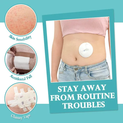 Vista 5 de Cubiertas de botón para tubo G, accesorios de diálisis peritoneal, almohadillas de tubo de alimentación, almohadillas de algodón para lactancia
