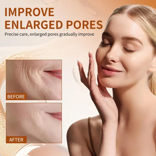 Vista 3 de Suero de retinol para cara con vitamina A Retinol Diseñado para pieles sensibles, suero facial de retinoles para penetración profunda, poros