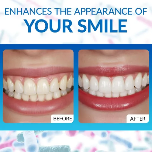 Vista 4 de Nano Hydroxyapatite Gum Probióticos Remineralizantes – Chicle de Xilitol Menta Sin Azúcar – Esmalte y Cuidado Oral – Soporte para el Aliento Fresco