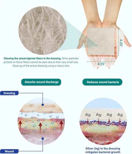 Vista 6 de Areza Silver - Almohadillas antibacterianas de alginato de calcio para heridas, estériles, antiadherentes, altamente absorbentes; para drenaje