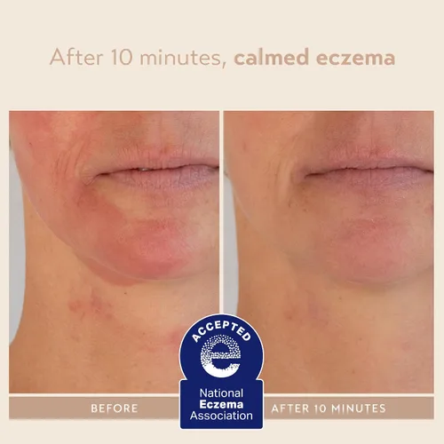 Vista 7 de SHANI DARDEN SKIN CARE Signature - Mascarilla facial nutritiva de arcilla de bentonita para calmar el enrojecimiento e irritación de la cara