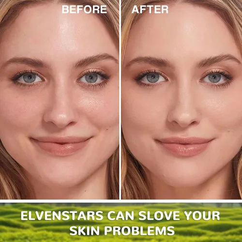 Vista 4 de Mascarilla de gelatina, cuidado facial de la piel, máscara facial para tratamientos faciales profesionales, mascarilla facial para hidratación