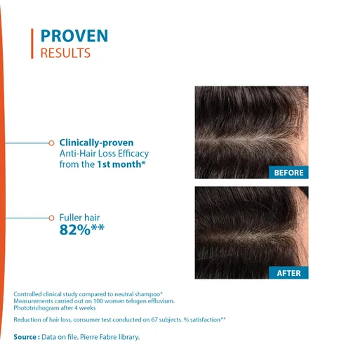 Vista 5 de Ducray Creastim Reactiv Loción para la pérdida del cabello 2.0 fl oz