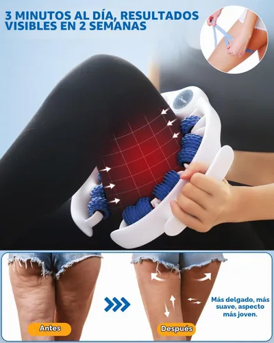 Vista 3 de ONUEMP Herramienta de Masaje para Celulitis, Removedor de Celulitis con Drenaje Linfático para Piernas, Rodillo Muscular para Masaje de Fascia