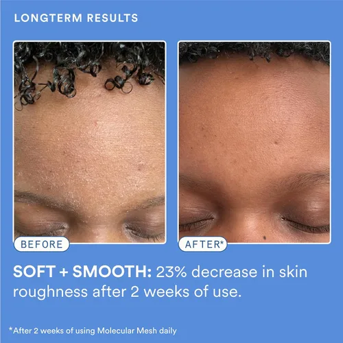 Vista 5 de Experiment Malla Molecular Barrera de Reparación Hidratante Facial - Crema Facial Ligera y Calmante para Fuerza, Enrojecimiento e Irritación