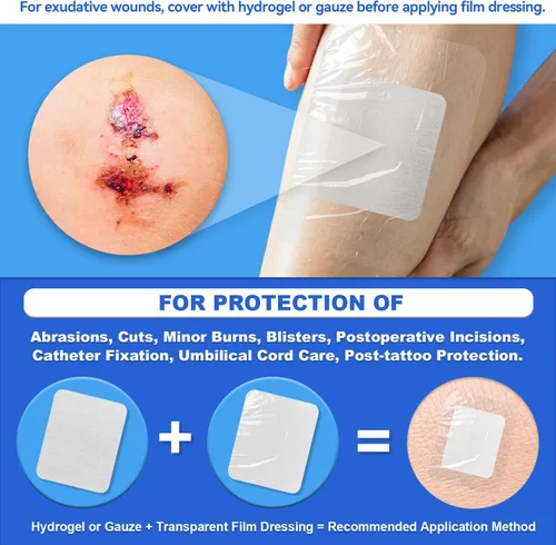 Vista 9 de FRESINIDER Apósito de película transparente de 2.3 x 2.75 pulgadas (paquete de 50) - Pequeños vendajes impermeables para ducha, cubierta