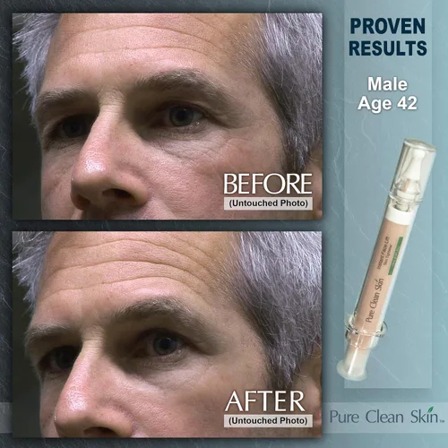 Vista 6 de EUZEN - Crema para apretar la piel para la cara – Obtén un estiramiento facial instantáneo en 3 a 5 minutos – esta crema antiarrugas para ojos