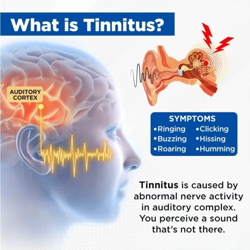 Vista 3 de Acupeace - Alivio de tinnitus para orejas zumbidas, dispositivo de alivio de tinnitus Acupeace, clip de oreja antitinnitus, dispositivo para detener